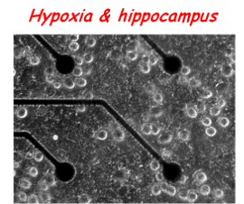 upload_PhyNe4_logo_hypoxia.png